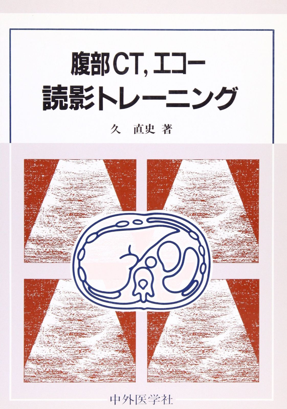 那須の祈り米　低農薬コシヒカリ新米30k 那須の祈り米 低農薬コシヒカリ新米30k