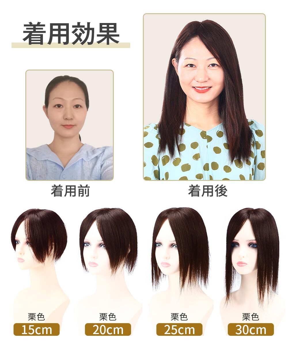 ☀ 円形脱毛症