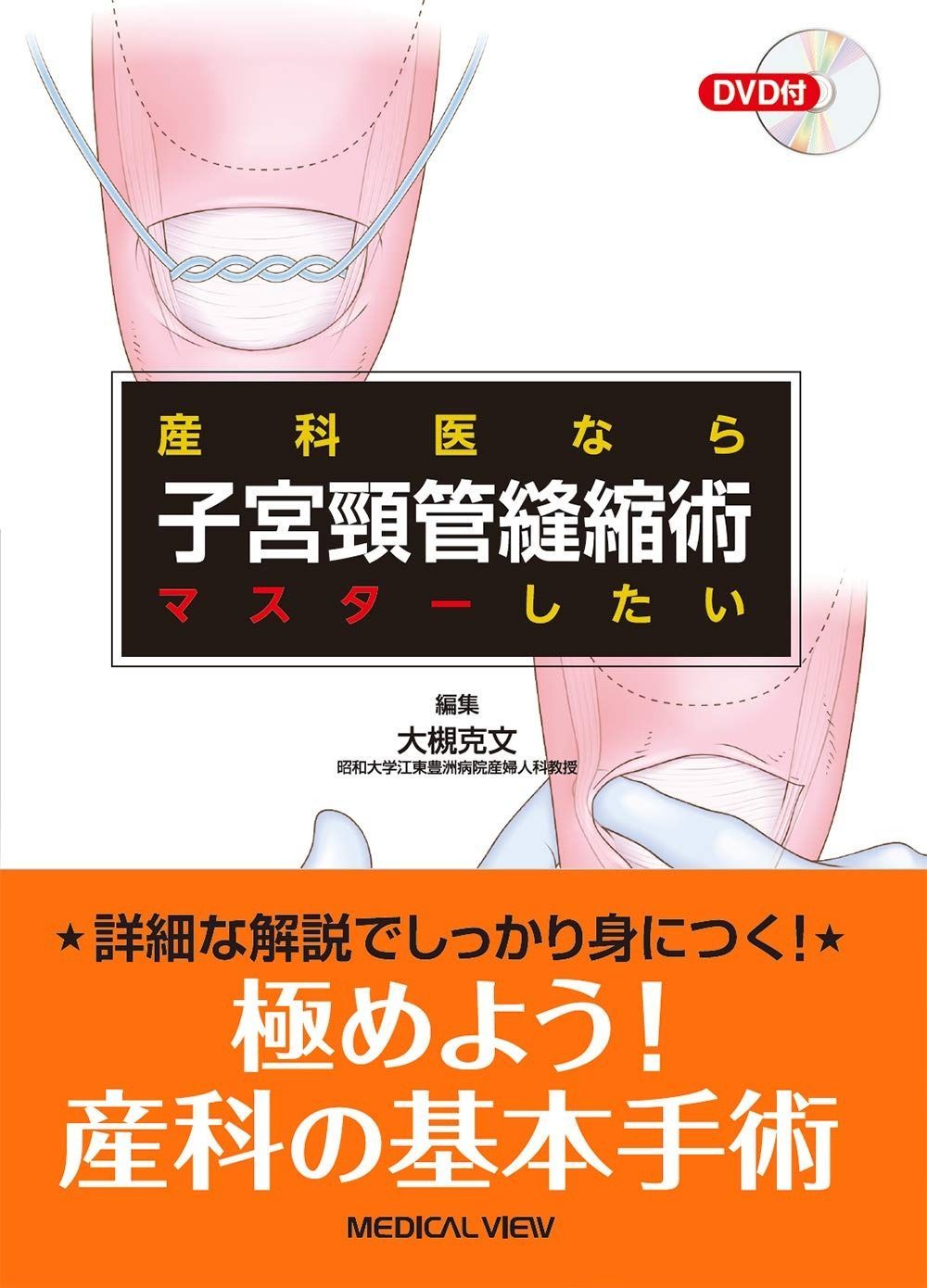 産科医ならマスターしたい 子宮頸管縫縮術
