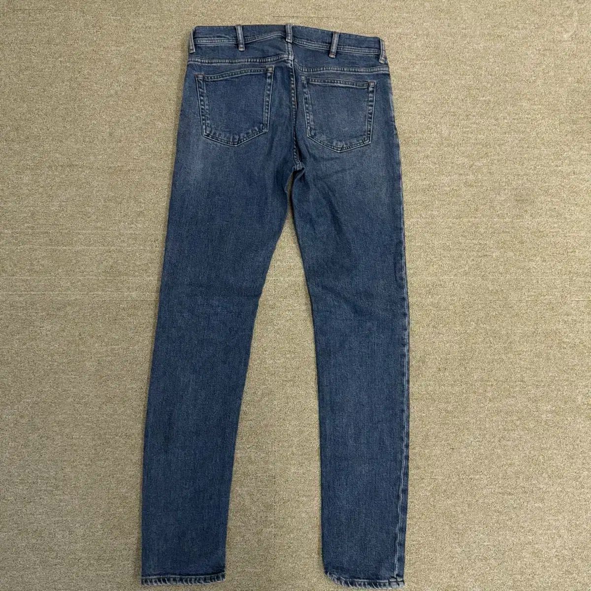 Acne