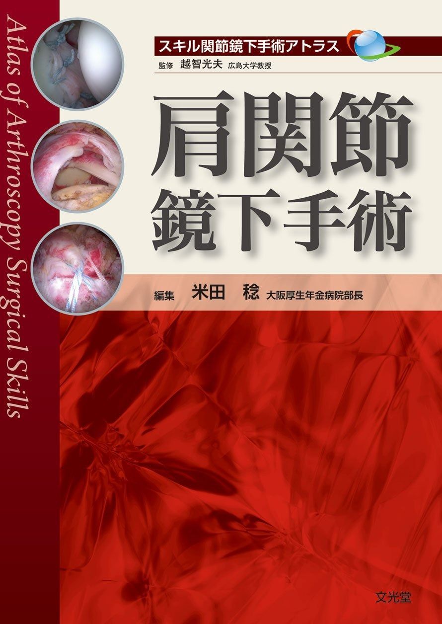 肩関節鏡下手術 (スキル関節鏡下手術アトラス) 肩関節鏡下手術 スキル関節鏡下手術アトラス 本 (スキル関節鏡下手術アトラス) 肩関節鏡下 健康&frasl;医学