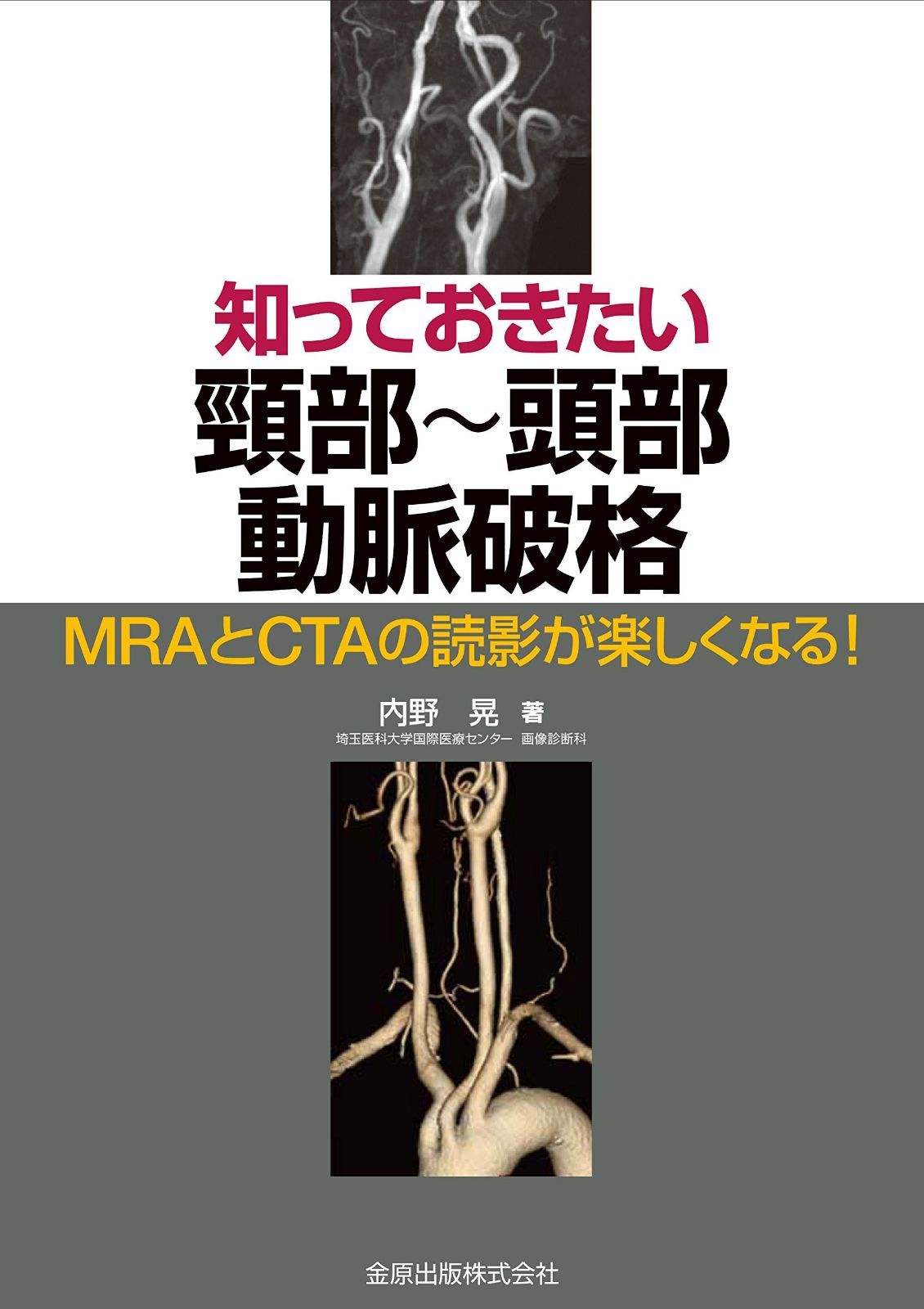 知っておきたい頸部~頭部動脈破格 MRAとCTAの読影が楽しくなる!