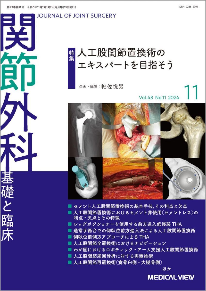 関節外科 -基礎と臨床 2024年11月号 特集：人工股関節置換術の