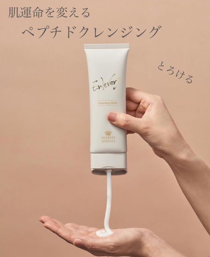 アンルヴェエクス