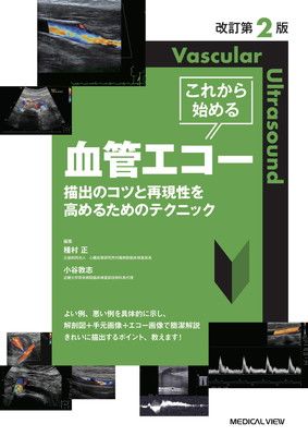 改訂第2版 これから始める血管エコー
