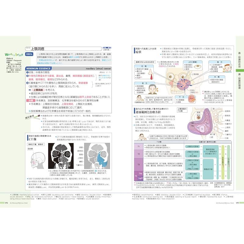 病気がみえる vol.13 耳鼻咽喉科 第1版 0 - メルカリ