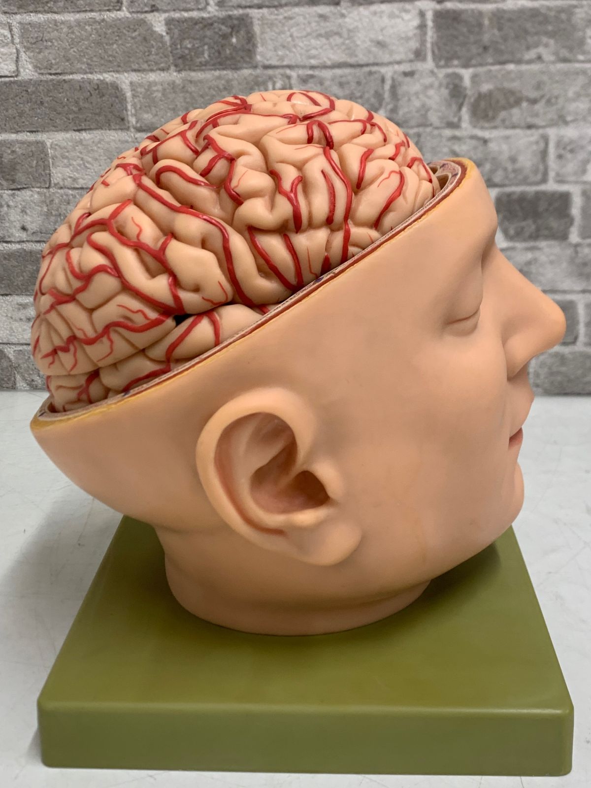 独SOMSO社 脳模型 人体解剖模型 ソムソー 医療器具 人体模型