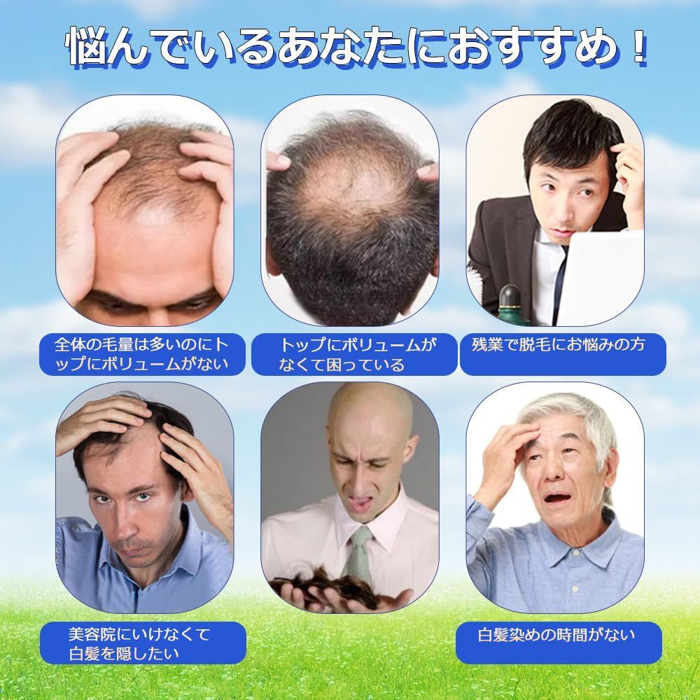 頭頂部