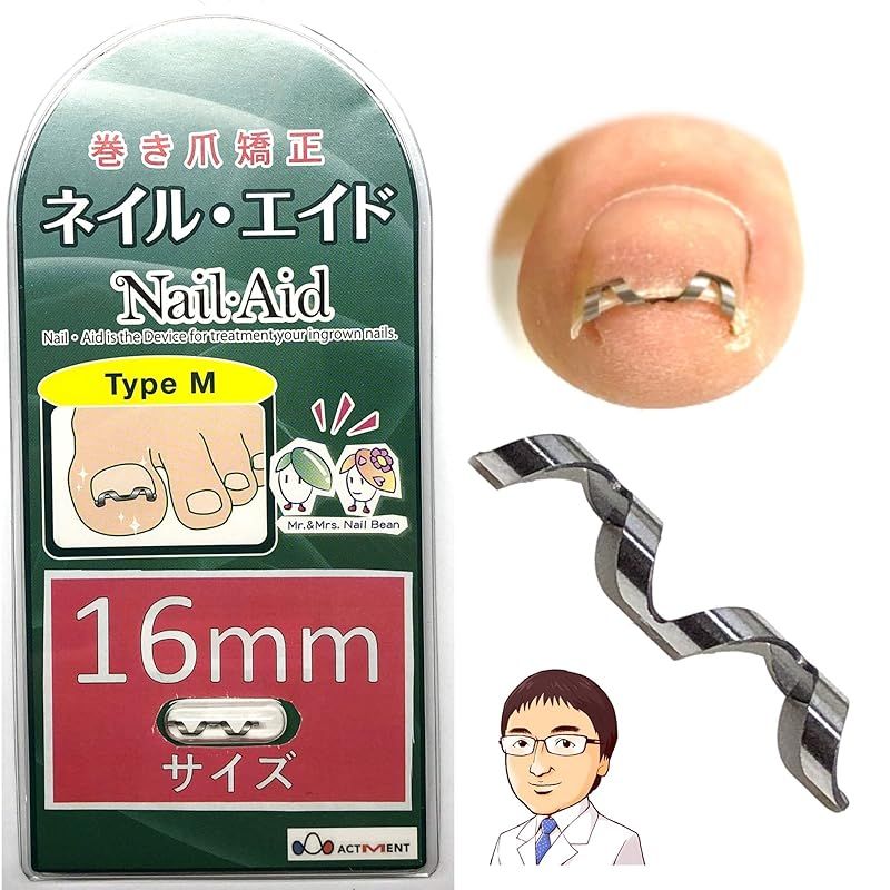 巻き爪