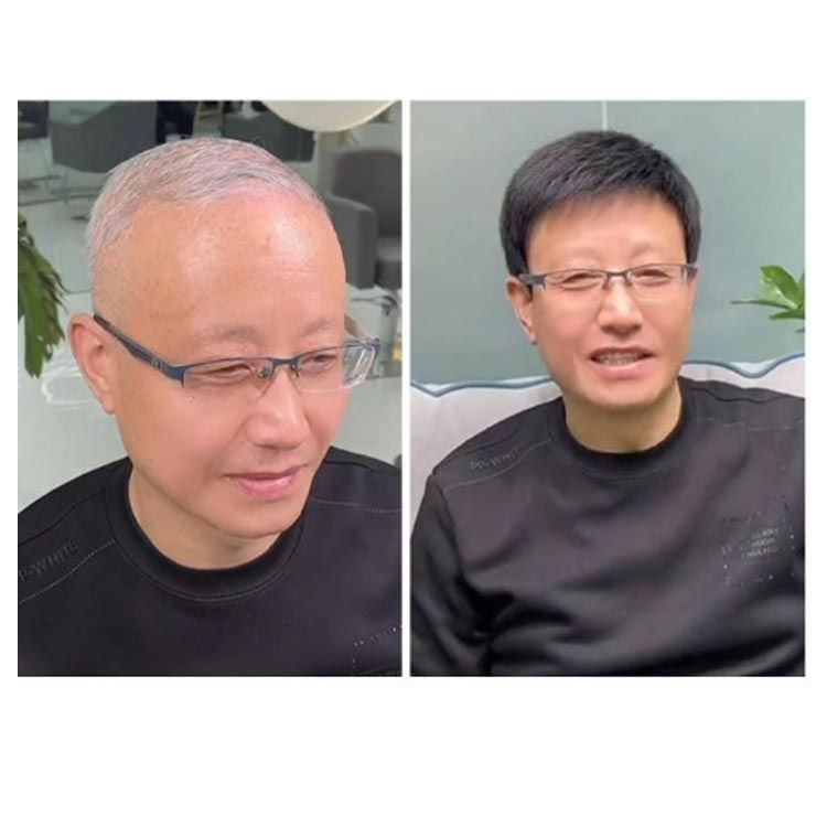 通気性 白髪隠し