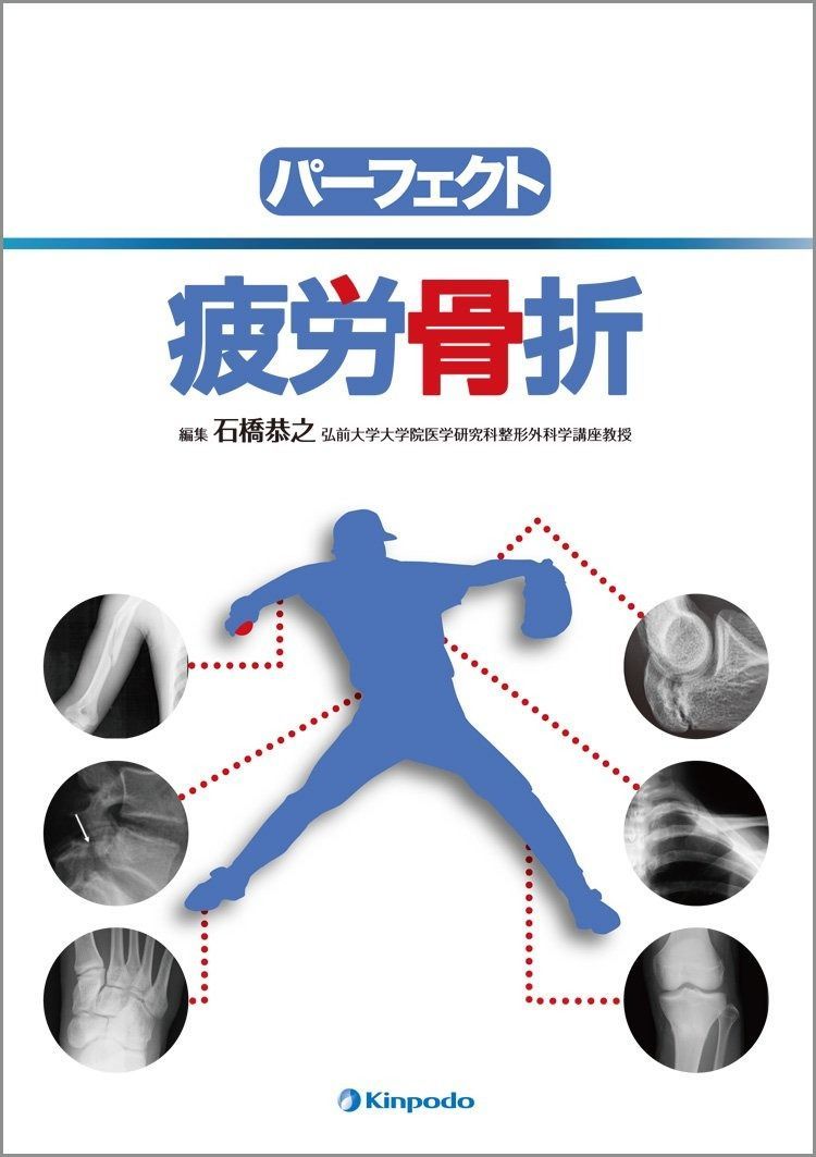 激安大特価，100%新品 パーフェクト疲労骨折 その他