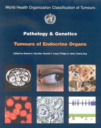 Pathology And Genetics of Tumors of Endocrine Organs (World Health Organization Classification of Tumours)