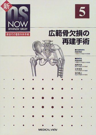 広範骨欠損の再建手術 (新OS NOW―新世代の整形外科手術) 宗昭，阿部、 幸英，岩本、 邦夫，高岡; 直之，落合 広範骨欠損の再建手術 (新OS NOW―新世代の整形外科手術) 宗昭
