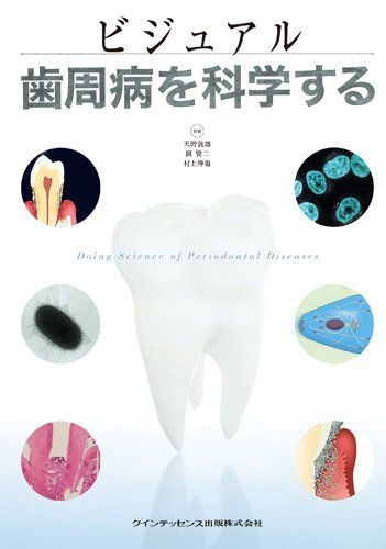 ビジュアル 歯周病を科学する [単行本（ソフトカバー）] 天野 敦雄、 岡 賢二; 村上 伸也