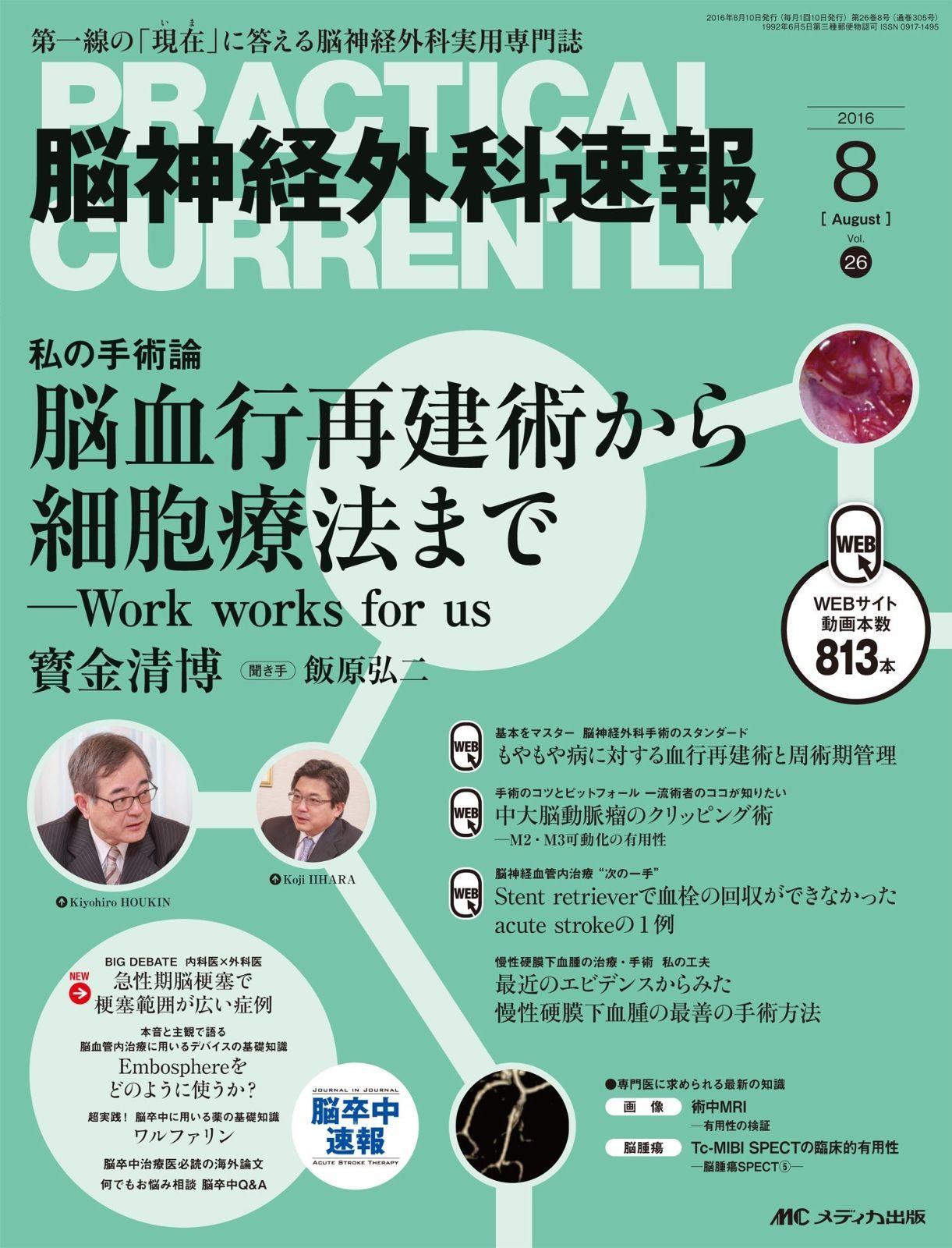 脳神経外科速報 2016年8月号(第26巻8号)特集:脳血行
