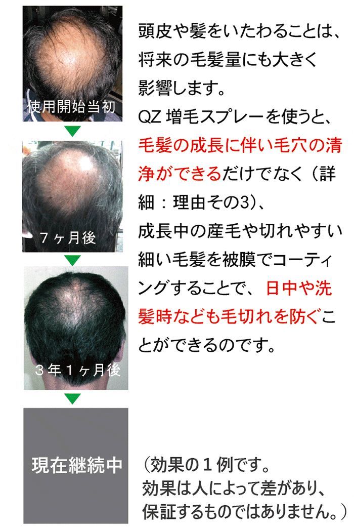 公式 QZ増毛スプレーのリアンドゥ