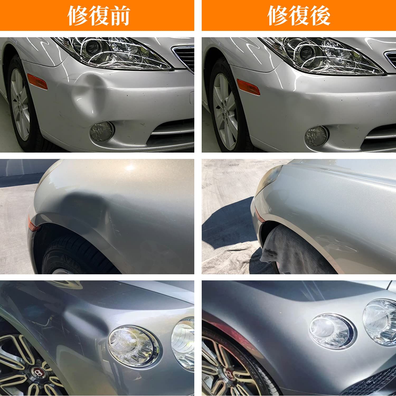 デントリペアキット