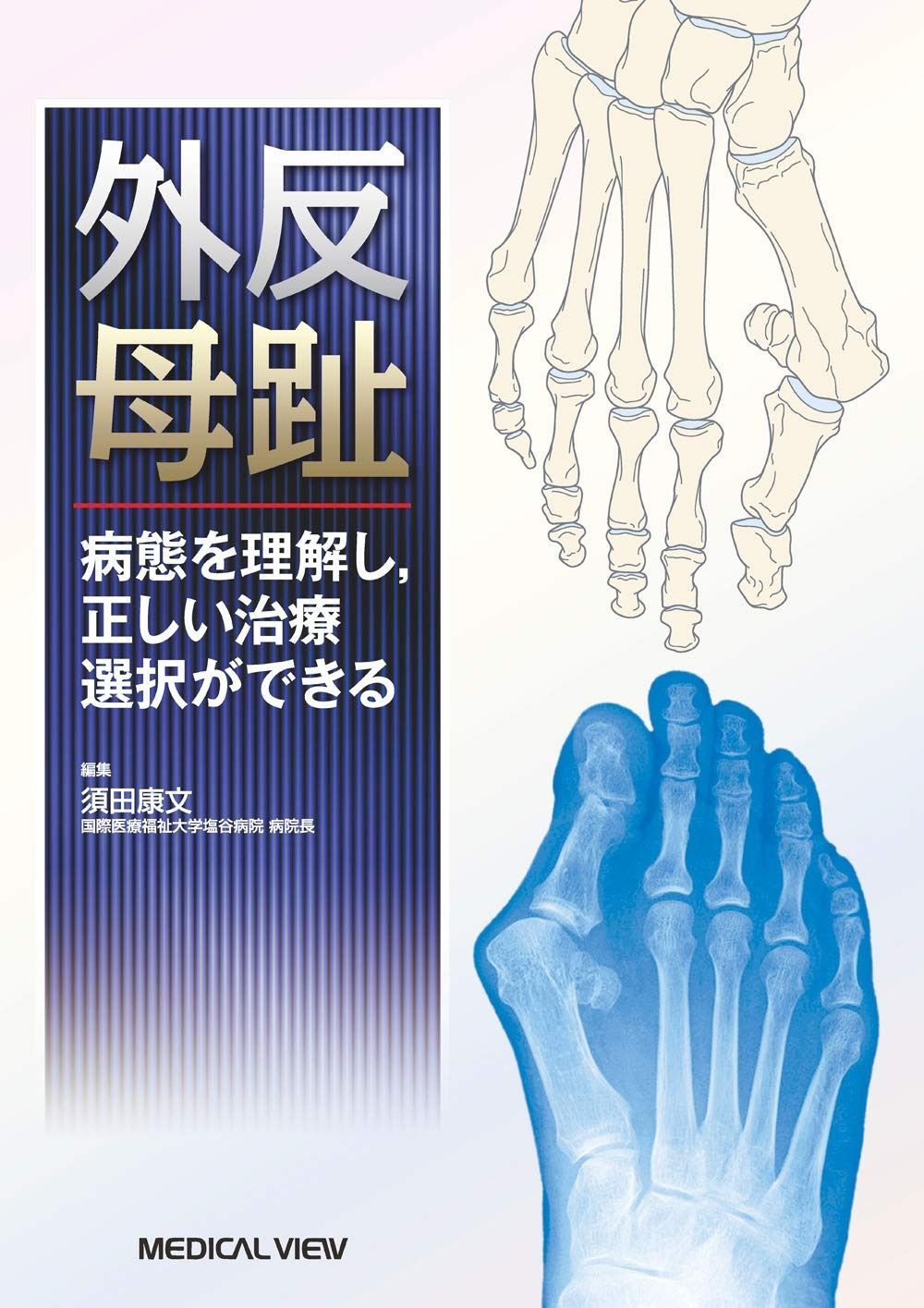 外反母趾?病態を理解し%ｶﾝﾏ%正しい治療選択ができる