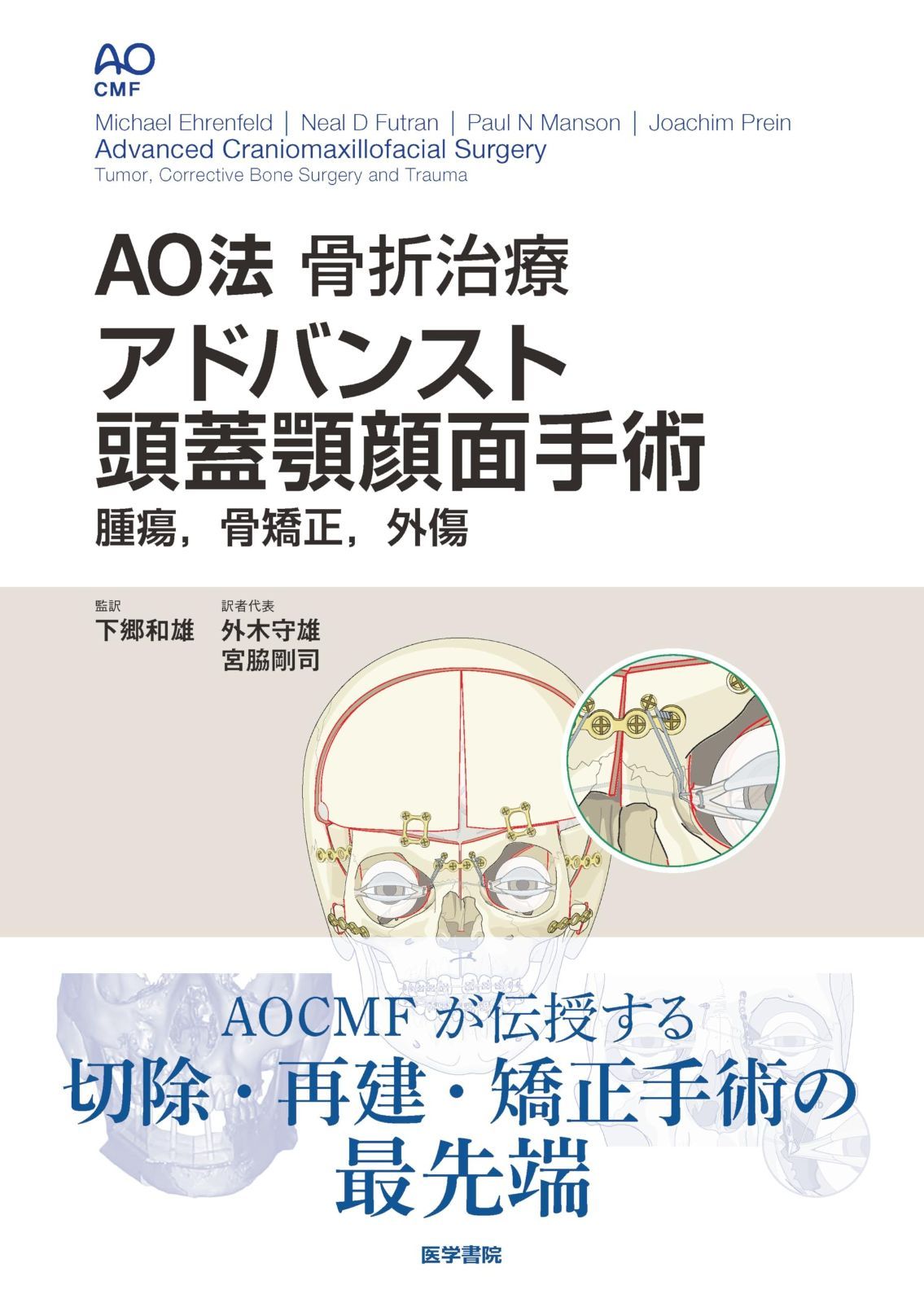 AO法骨折治療 アドバンスト頭蓋顎顔面手術: 腫瘍、骨矯正、外傷