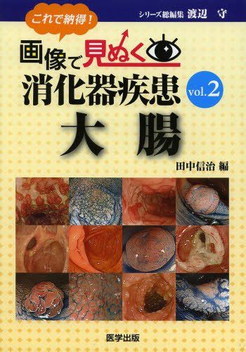 これで納得! 画像で見ぬく消化器疾患 vol.1 上部消化管 これで納得! 画像で見ぬく消化器疾患 vol.1 上部消化管 | 渡辺