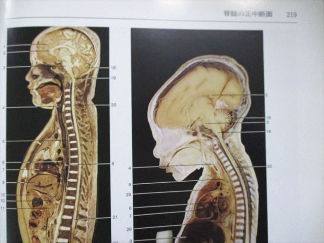 解剖学カラーアトラス 第9版