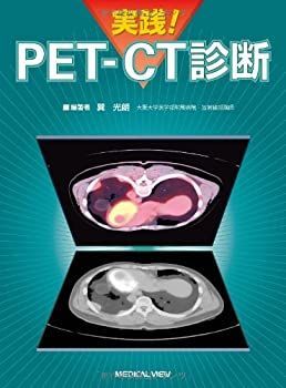 【中古】 実践! PET-CT診断