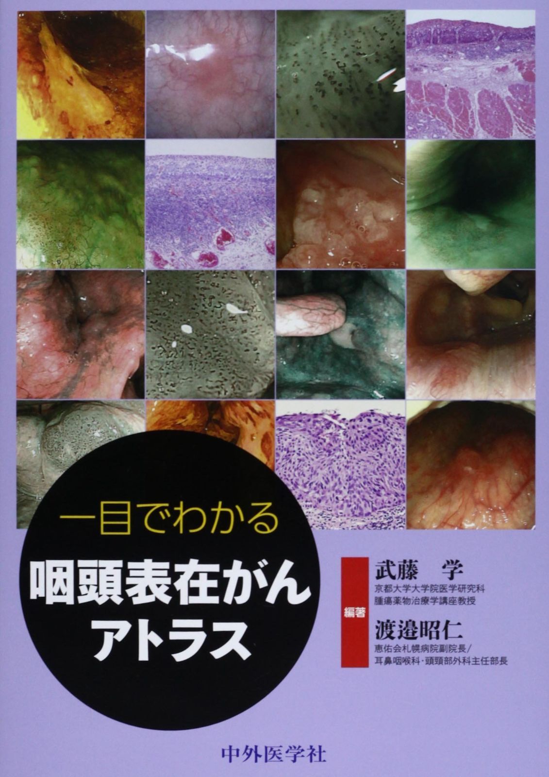 一目でわかる咽頭表在がんアトラスの通販 一目でわかる咽頭表在がん