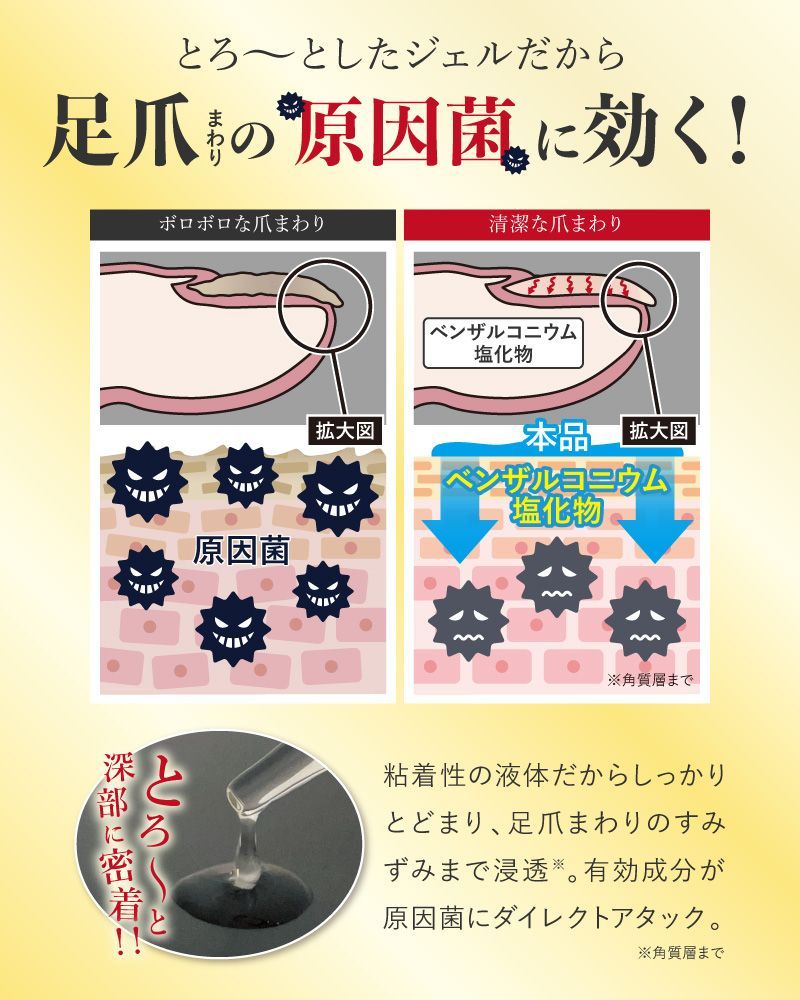 薬用足爪ジェル×３本セット 薬用ATジェル 指定医薬部外品 足爪まわりの原因菌に効く 有効成分がツメの乾燥 割れをしっかりケア 爪トラブル 足爪 菌 爪水虫 爪白癬 爪まわり 清潔 保湿 爪割れ 予防 爪の悩み 爪 消毒 外皮消毒剤