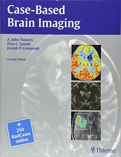Case-Based Brain Imaging Tsiouris A. John M.D. Sanelli Pi