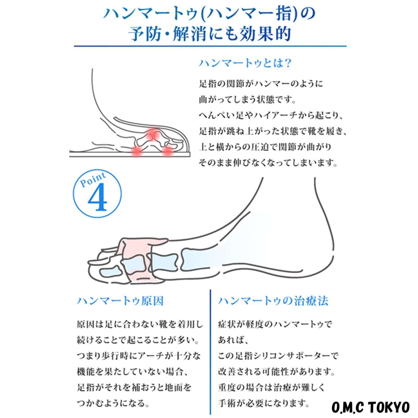 【新品・未使用】【匿名配送】足指セパレーター　足指サポーター　足指広げる　足指開き　足指パッド　シリコン素材　簡単着脱　水洗い可能　男女兼用　2個セット