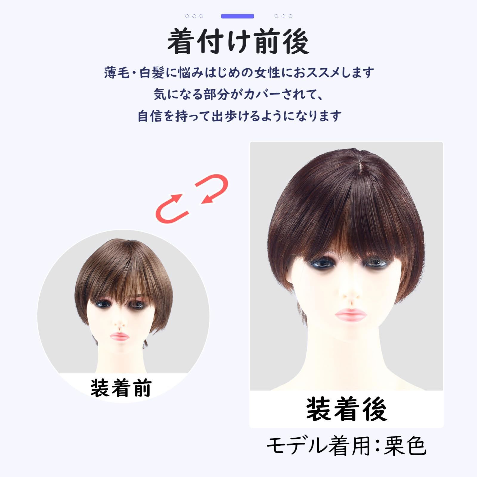 増量 円形脱毛