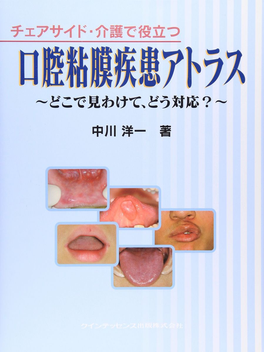 チェアサイド・介護で役立つ口腔粘膜疾患アトラス: どこで見わけ