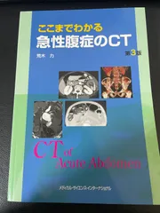 ここまでわかる急性腹症のCT - メルカリ