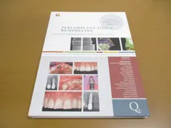 ▲01)【1点限り!】インプラント周囲の組織再形成/リモデリング/Peri-Implant Tissue…/Luigi Canullo/Quintessence/洋書/A