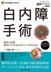 本 網膜硝子体手術：基本と応用，トラブル＆リカバリーがわかる