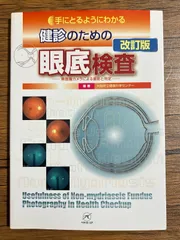 手にとるようにわかる健診のための眼底検査　改訂版　無散瞳カメラによる撮影と判定 手にとるようにわかる健診のための眼底検査 無散瞳カメラによる撮影と