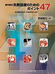 裁断済み】パーシャルデンチャー治療失敗回避のためのポイント47
