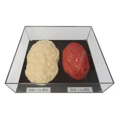 脂肪模型 　1kg 3kgの２つセット Amazon.co.jp: 【病院食】脂肪模型/筋肉模型対比セット アクリルケース