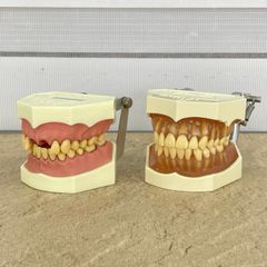NISSIN DENTAL MODEL 顎模型 頬粘膜 舌付 - メルカリ