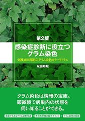 DVD版 見てわかるSSTステップ・バイ・ステップ方式 2DAYSワーク