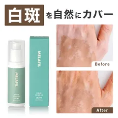 MELAFIL 白斑 防水 カバー メイク コンシーラー リキッド 韓国製 レディース メンズ  Vitiligo Cover Concealerのサムネイル