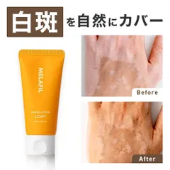 MELAFIL 白斑 ローション カバー コンシーラー 保湿 韓国製 レディース メンズ 韓国製 Vitiligo Cover Concealerのサムネイル