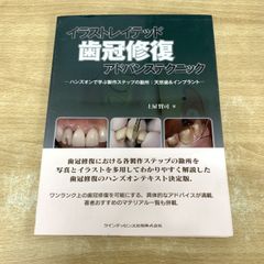 イラストレイテッド 歯冠修復 アドバンステクニック - メルカリ