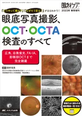 眼底写真撮影、OCT・OCTA検査のすべて（単行本（ソフトカバー））