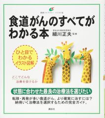 食道がんのすべてがわかる本 (健康ライブラリー イラスト版)(中古)