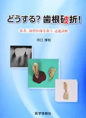 どうする?歯根破折!―患者，歯科医師を救う迅速診断 [大型本] 河口 博和 どうする?歯根破折!―患者，歯科医師を救う迅速診断 [大型本