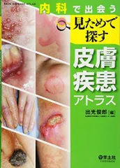 皮膚付属器腫瘍アトラス　裁断済み Amazon.co.jp: 皮膚付属器腫瘍アトラス : 安齋眞一, 後藤啓介: 本