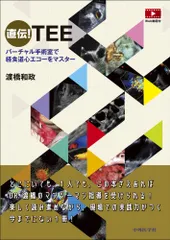 2025年最新】経食道心エコーの人気アイテム - メルカリ
