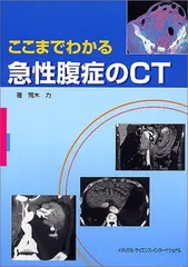 2025年最新】急性腹症のctの人気アイテム - メルカリ