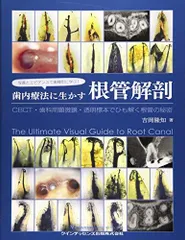 裁断済み 臨床根管解剖 : 基本的知識と歯種別の臨床ポイント 歯内療法 成功への道 臨床根管解剖: 基本的知識と歯種別の臨床